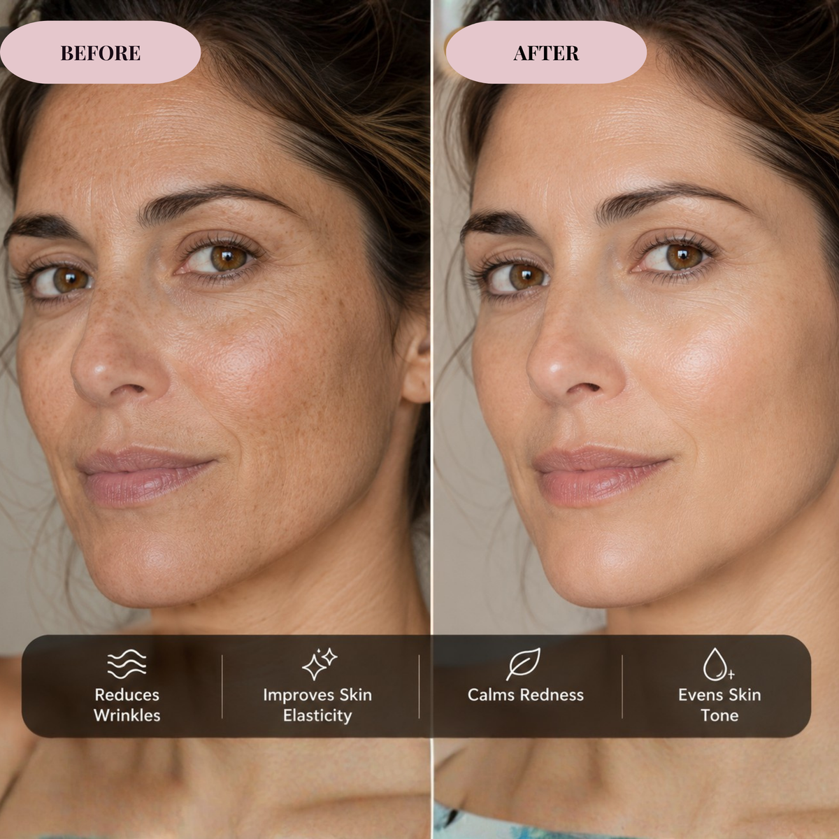 red-light-mask-juvine-model-smile before-after